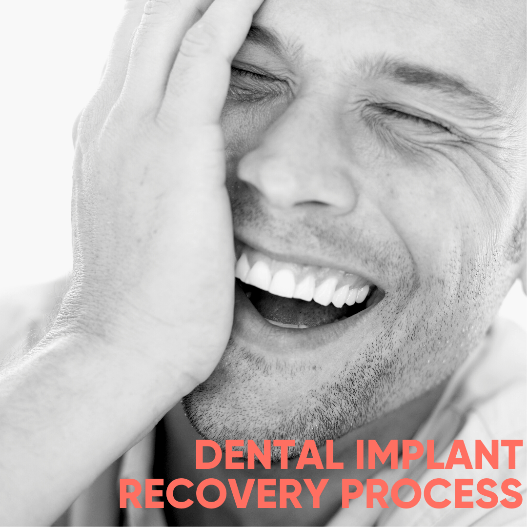 Dental Implant Recovery Process
